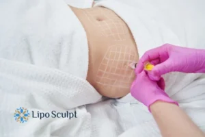 Are The Results From Aqualyx Permanent? 1 Do you want to know how long Aqualyx Woburn Sands results last?