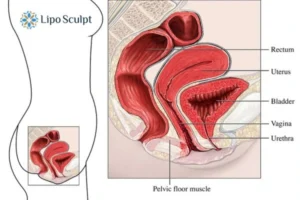 Treatment For A Leaky Bladder 2 How EM Chair treatment Woburn Sands can help Leaky bladder issues. Read more now!