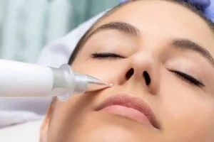Best Actinic Keratoses Removal 3 Actinic keratoses Woburn Sands solutions - book in today!