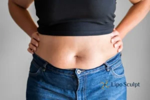 Bidding Farewell to Muffin Tops with Aqualyx Fat Injections 2 Do you wish you could reduce your muffin top Woburn Sands With Aqualy fat dissolving injections you can!